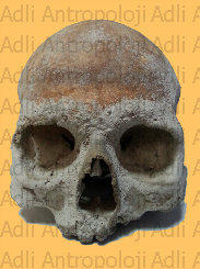 http://www.adliantropoloji.com/images/20140520_162716.jpg