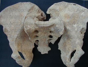 http://www.adliantropoloji.com/images/tmpADE0.png